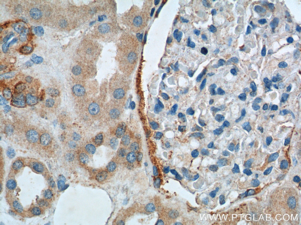 Immunohistochemistry (IHC) staining of human kidney tissue using C20orf3/APMAP Polyclonal antibody (25953-1-AP)