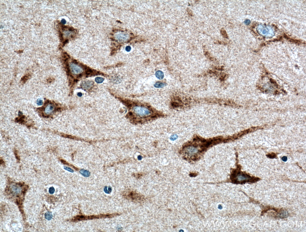 Immunohistochemistry (IHC) staining of human brain tissue using TMEM230 Polyclonal antibody (21466-1-AP)