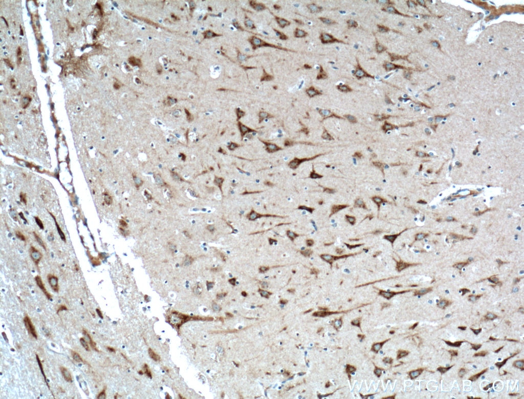 IHC staining of human brain using 21466-1-AP