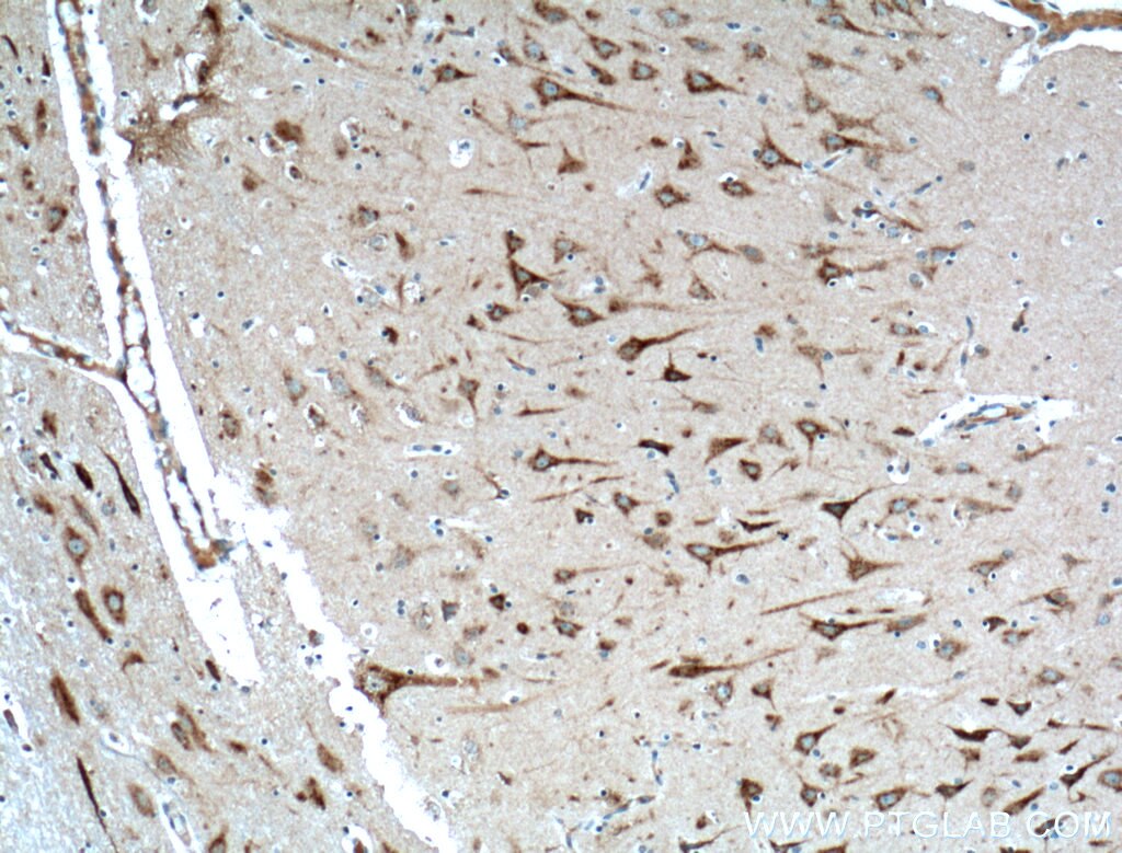 Immunohistochemistry (IHC) staining of human brain tissue using TMEM230 Polyclonal antibody (21466-1-AP)