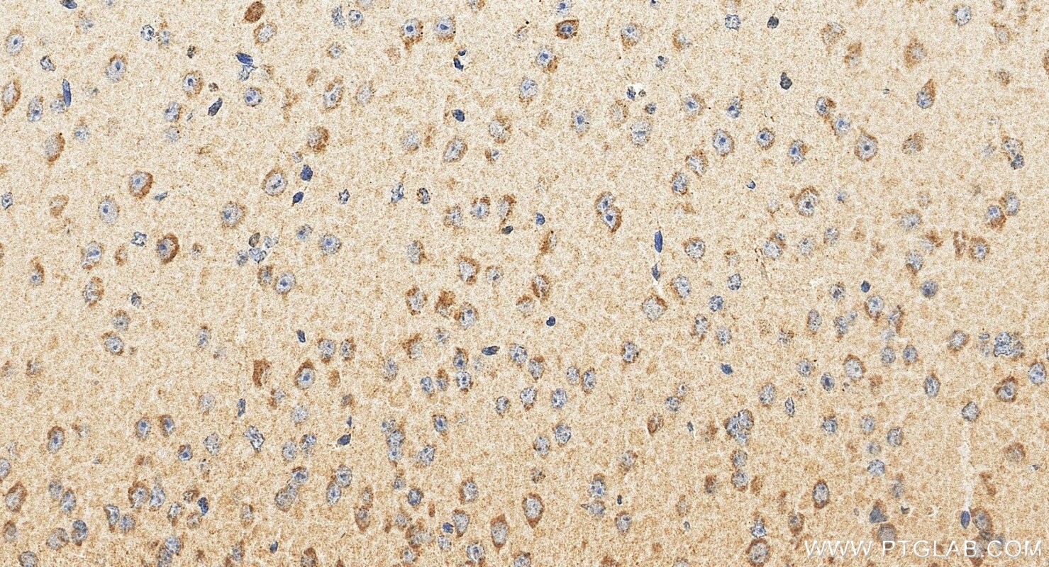 IHC staining of mouse brain using 21466-1-AP Immunohistochemistry (IHC) staining of mouse brain tissue using TMEM230 Polyclonal antibody (21466-1-AP)