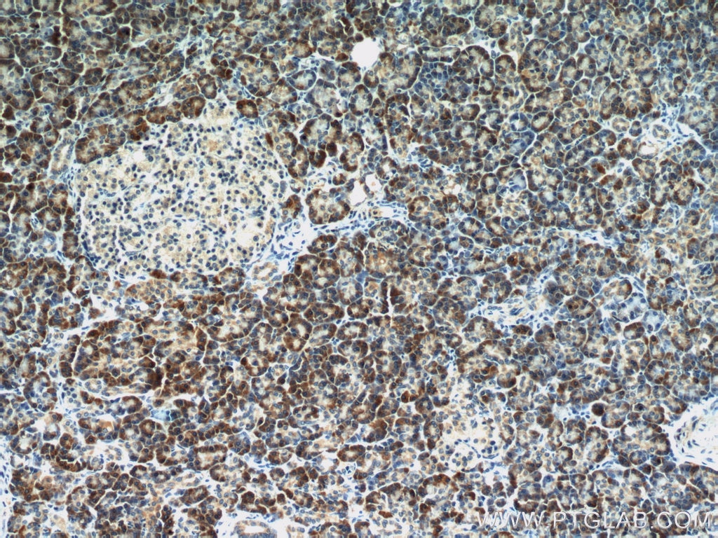 Immunohistochemistry (IHC) staining of human pancreas tissue using TMEM230 Polyclonal antibody (21466-1-AP)