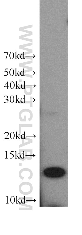 WB analysis of HeLa using 21466-1-AP