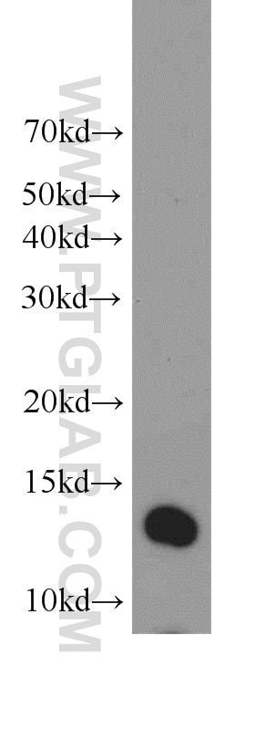 Western Blot (WB) analysis of HEK-293 cells using TMEM230 Polyclonal antibody (21466-1-AP)