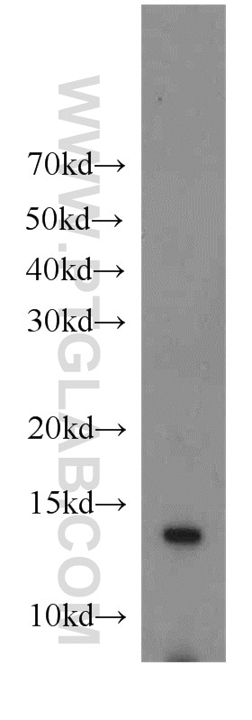 Western Blot (WB) analysis of COLO 320 cells using TMEM230 Polyclonal antibody (21466-1-AP)