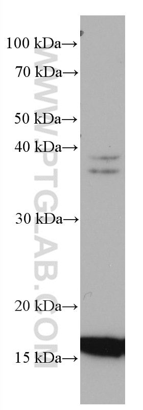 Western Blot (WB) analysis of HeLa cells using TMEM230 Monoclonal antibody (67247-1-Ig)
