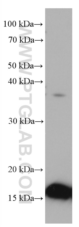 WB analysis of COLO 320 using 67247-1-Ig