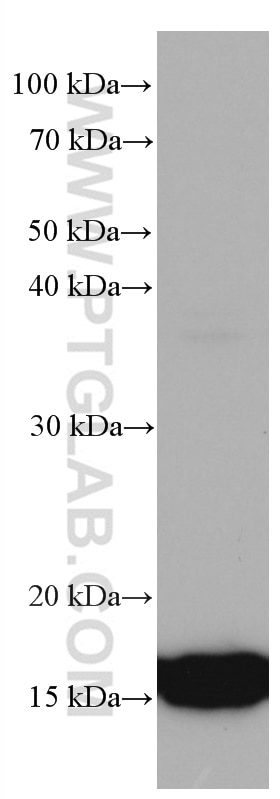 Western Blot (WB) analysis of A549 cells using TMEM230 Monoclonal antibody (67247-1-Ig)