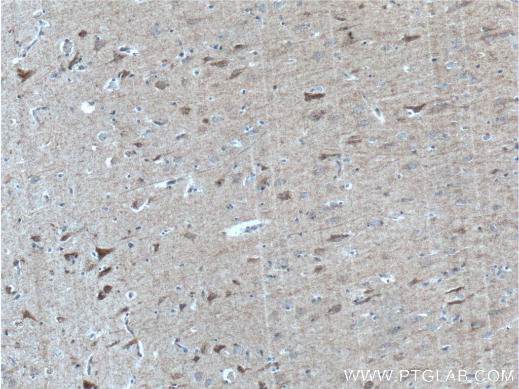 Immunohistochemistry (IHC) staining of human brain tissue using SYNDIG1 Polyclonal antibody (27537-1-AP)