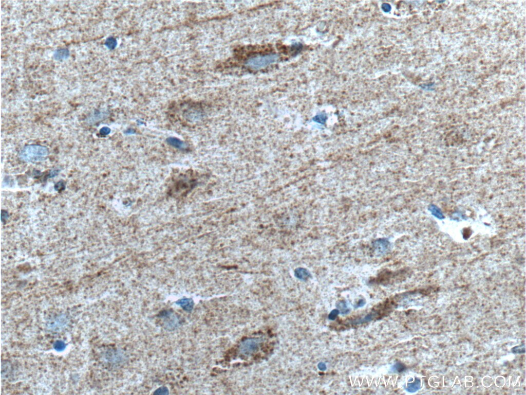 Immunohistochemistry (IHC) staining of human brain tissue using SYNDIG1 Polyclonal antibody (27537-1-AP)