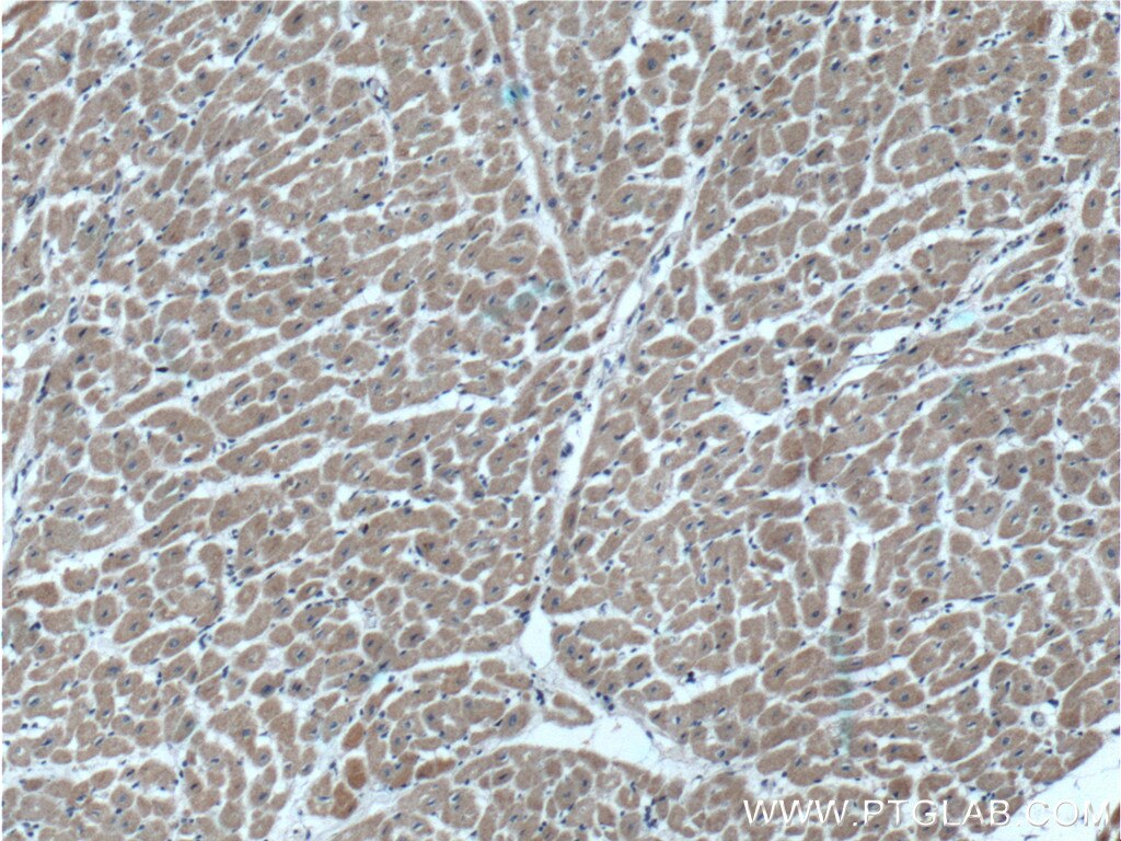 Immunohistochemistry (IHC) staining of human heart tissue using SYNDIG1 Polyclonal antibody (27537-1-AP)