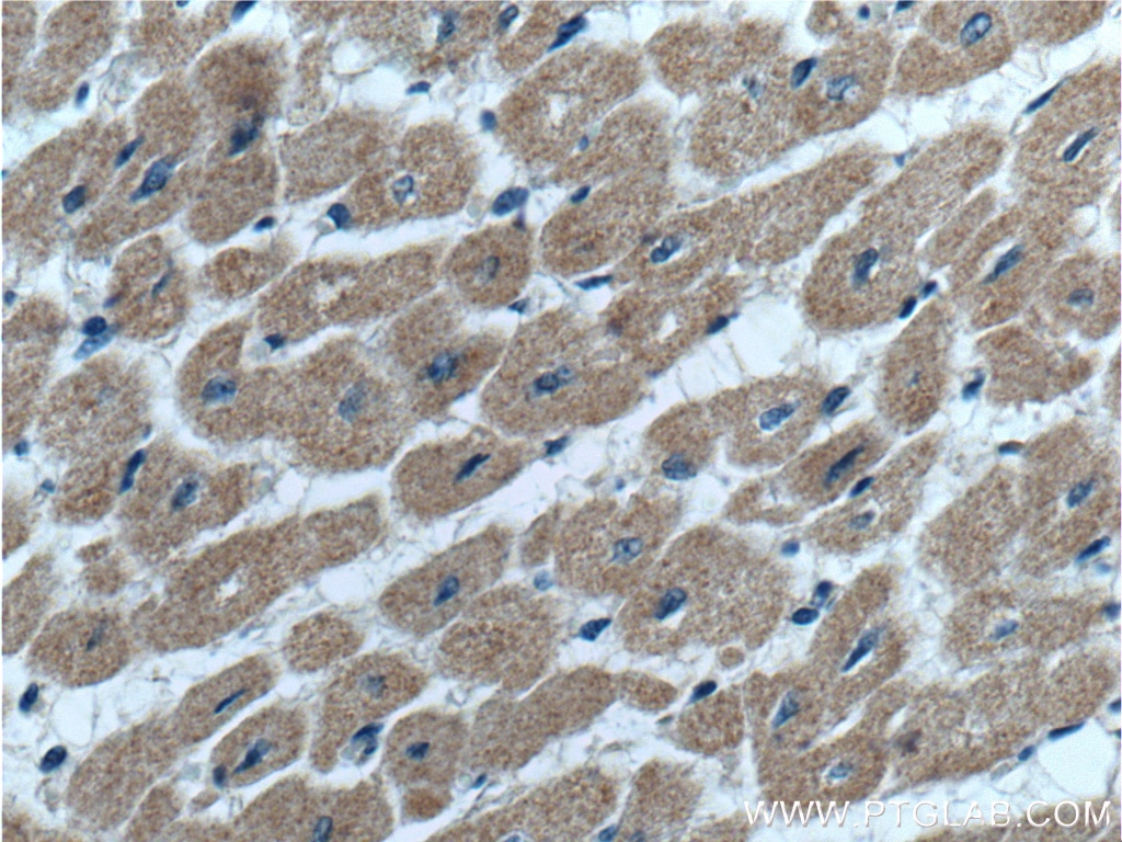 Immunohistochemistry (IHC) staining of human heart tissue using SYNDIG1 Polyclonal antibody (27537-1-AP)