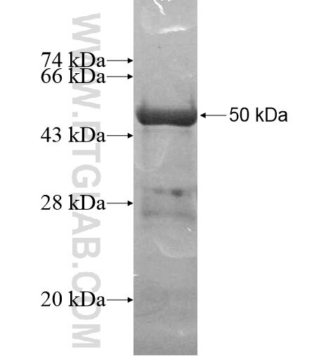 C20orf4 fusion protein Ag14039 SDS-PAGE
