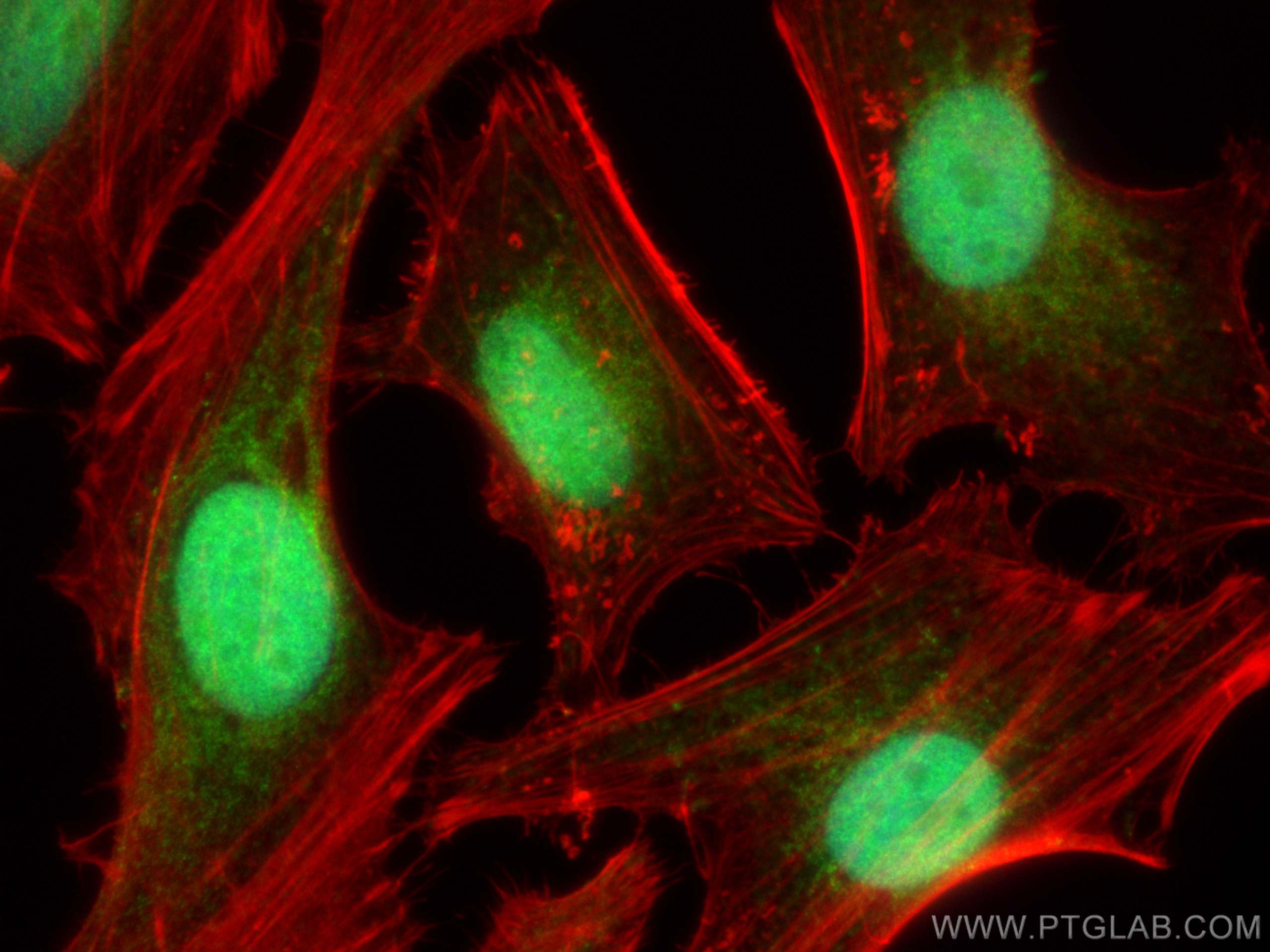 IF Staining of HeLa using 16633-1-AP