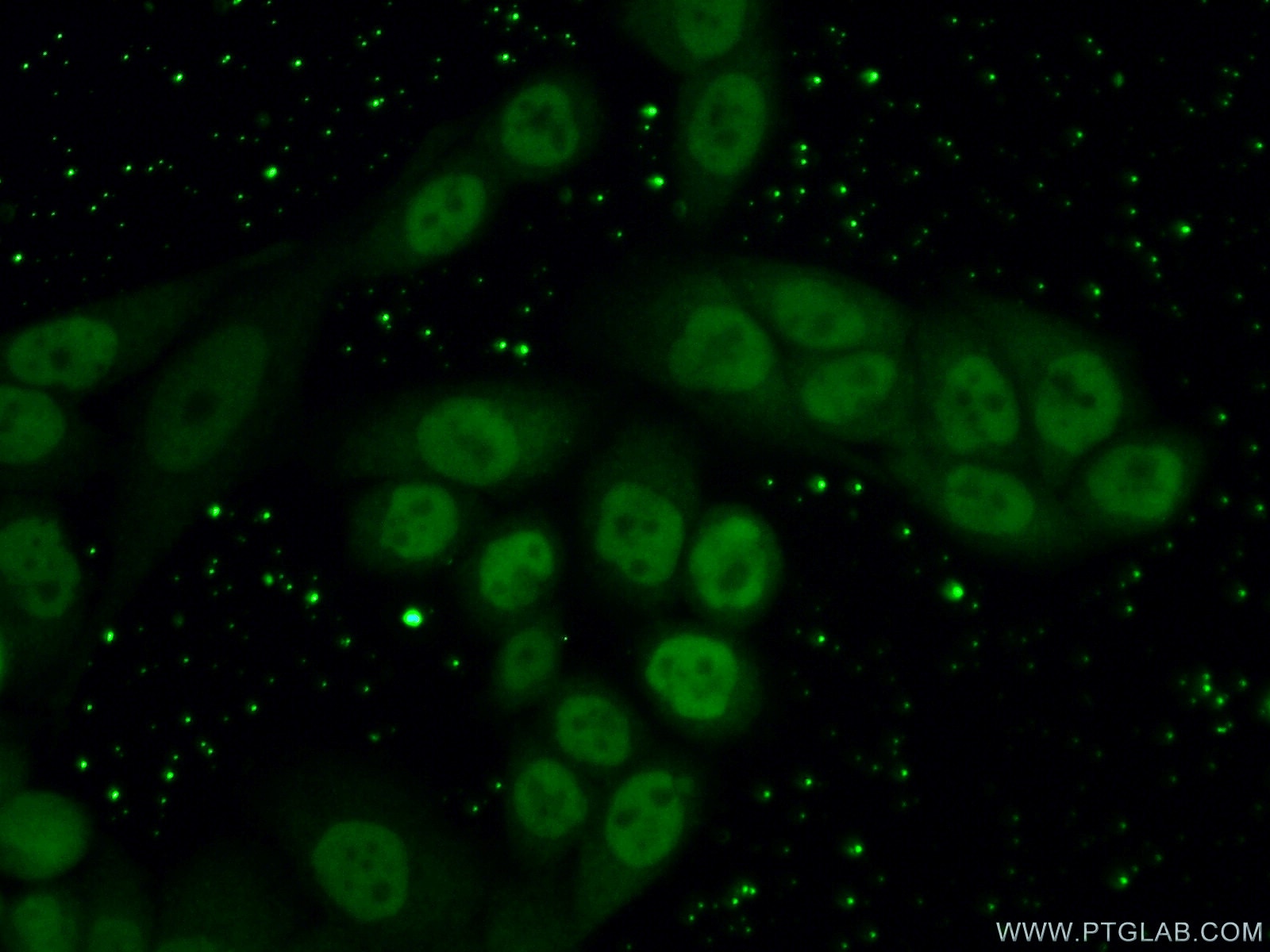 Immunofluorescence (IF) / fluorescent staining of HeLa cells using RTF2 Polyclonal antibody (16633-1-AP)