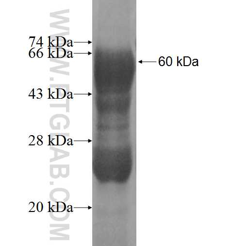 C20orf43 fusion protein Ag9972 SDS-PAGE