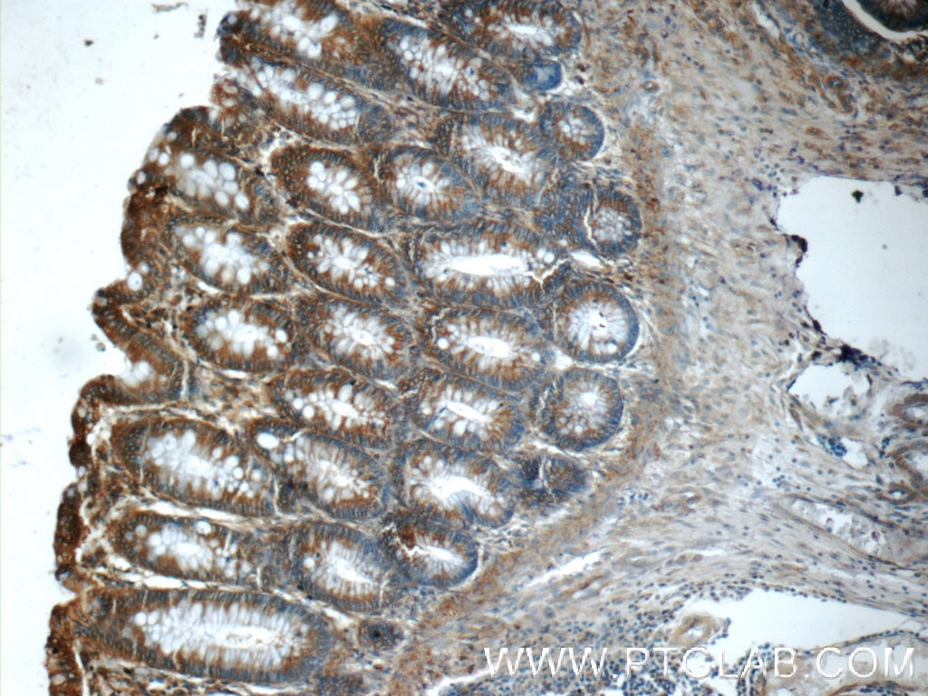 IHC staining of human colon using 24678-1-AP