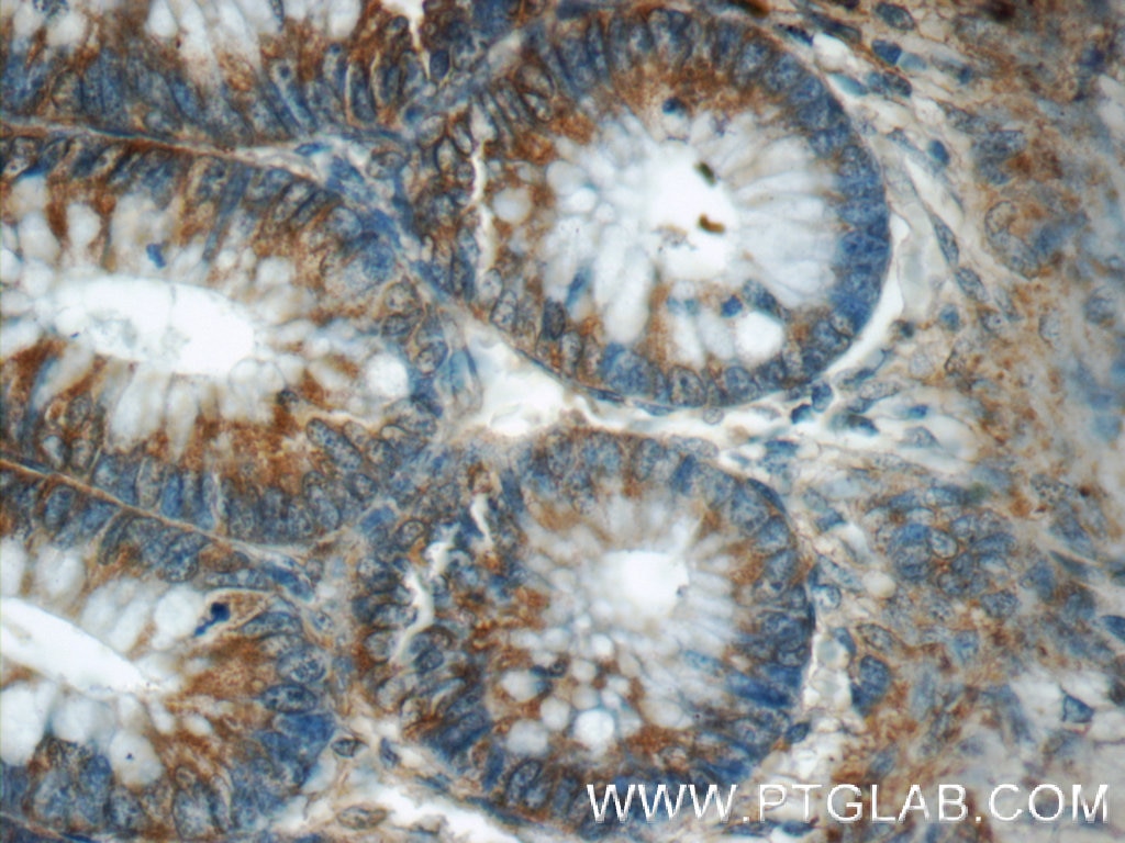 Immunohistochemistry (IHC) staining of human colon tissue using C20orf46 Polyclonal antibody (24678-1-AP)