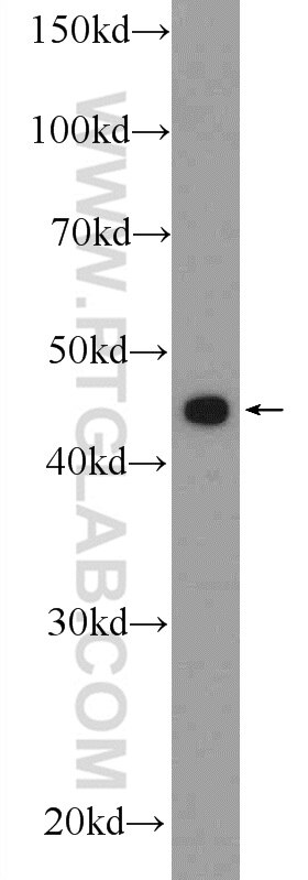 Western Blot (WB) analysis of Jurkat cells using C20orf46 Polyclonal antibody (24678-1-AP)