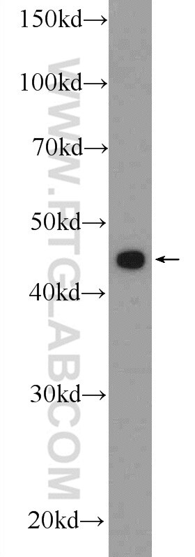 WB analysis of Jurkat using 24678-1-AP