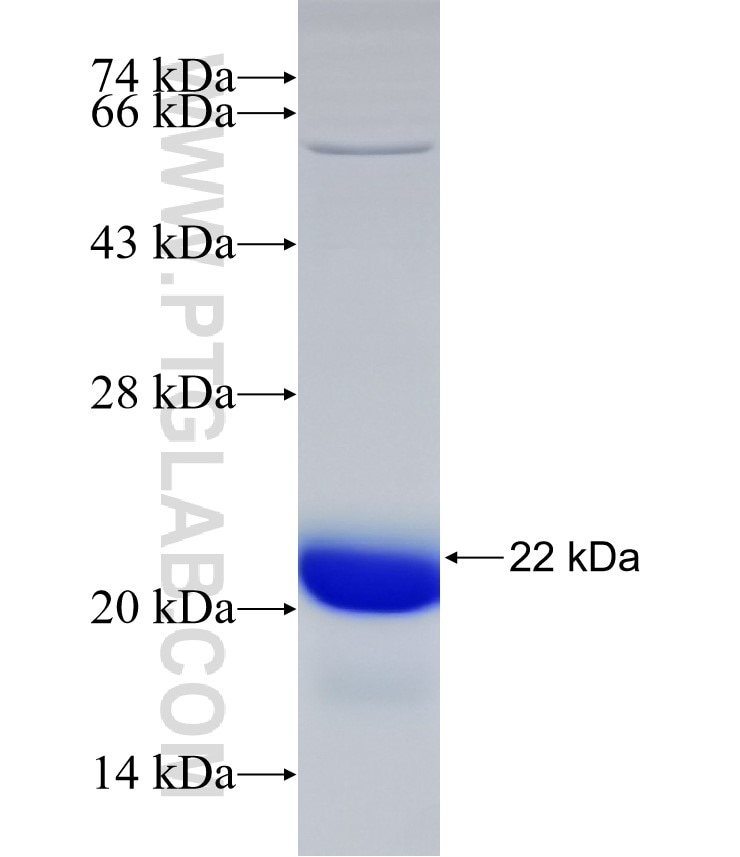 C20orf46 fusion protein Ag33049 SDS-PAGE C20orf46 fusion protein Ag33049 SDS-PAGE