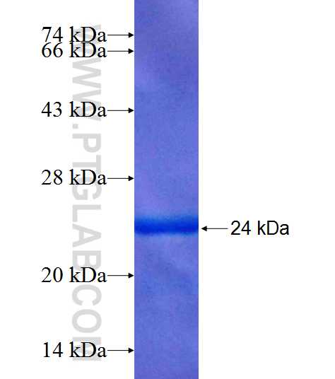 C20orf46 fusion protein Ag20385 SDS-PAGE