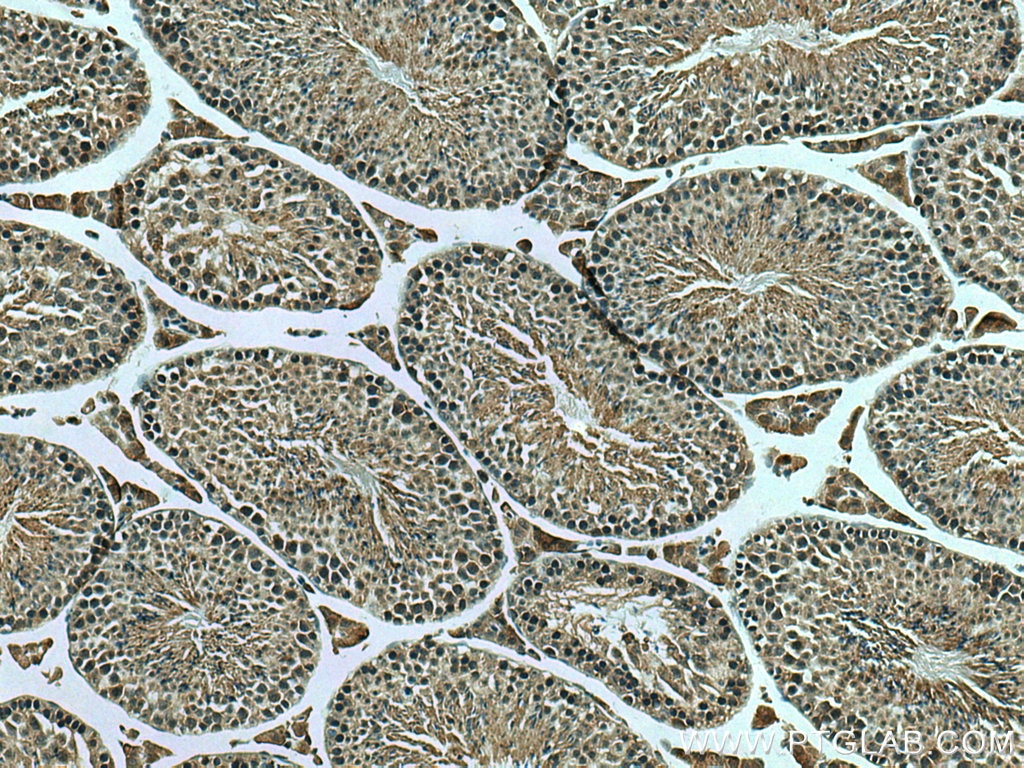 Immunohistochemistry (IHC) staining of mouse testis tissue using SLC52A3 Polyclonal antibody (25626-1-AP)