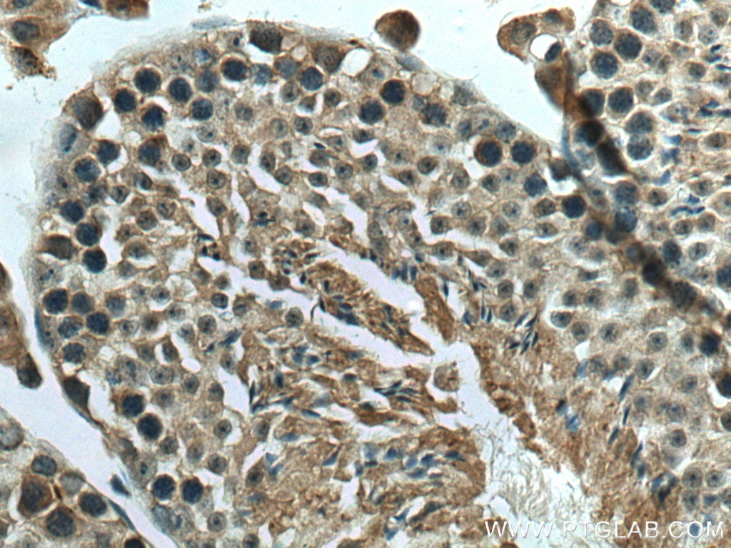 Immunohistochemistry (IHC) staining of mouse testis tissue using SLC52A3 Polyclonal antibody (25626-1-AP)