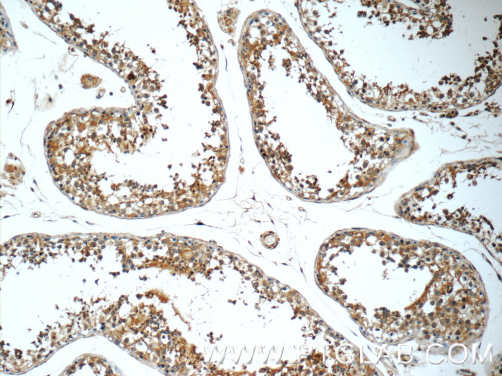 Immunohistochemistry (IHC) staining of human testis tissue using SLC52A3 Polyclonal antibody (25626-1-AP)