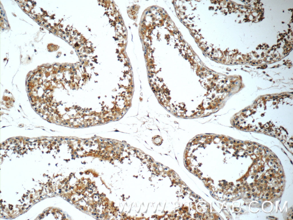 IHC staining of human testis using 25626-1-AP