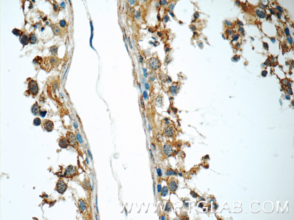 Immunohistochemistry (IHC) staining of human testis tissue using SLC52A3 Polyclonal antibody (25626-1-AP)