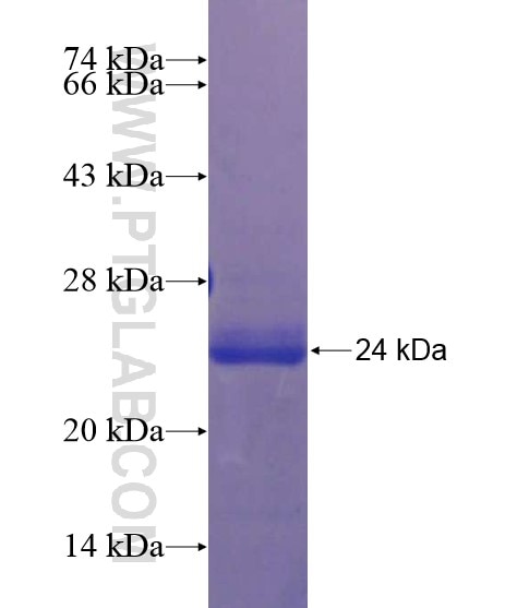 C20orf54 fusion protein Ag22315 SDS-PAGE