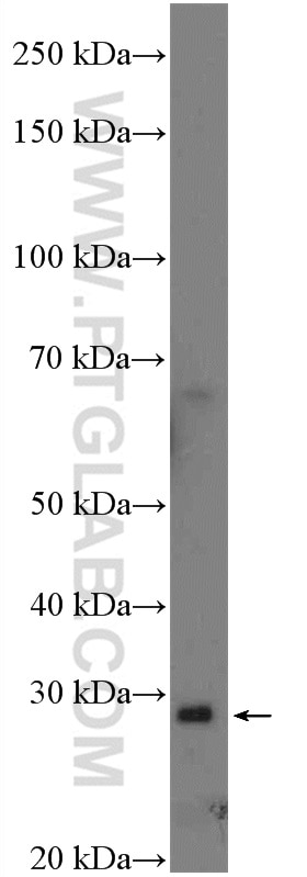 Western Blot (WB) analysis of HeLa cells using NDUFAF5 Polyclonal antibody (26359-1-AP)
