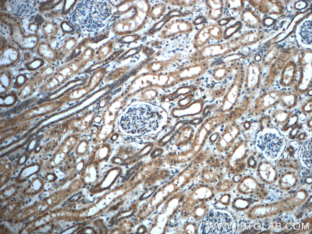 Immunohistochemistry (IHC) staining of human kidney tissue using MGME1 Polyclonal antibody (23178-1-AP)