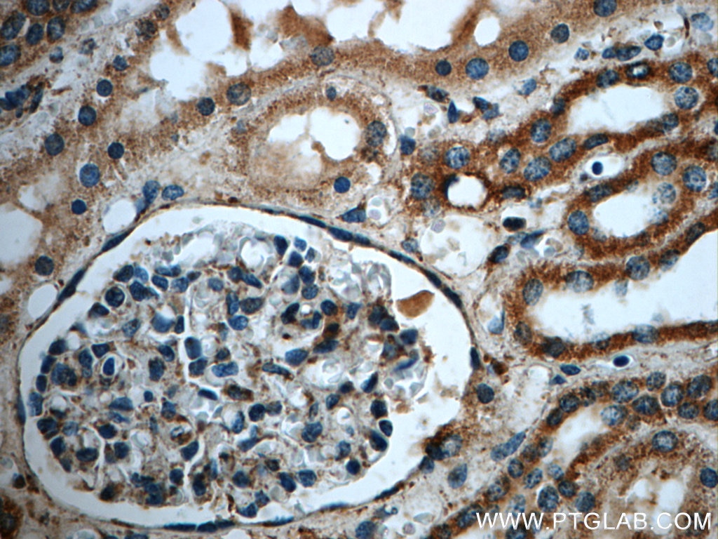 Immunohistochemistry (IHC) staining of human kidney tissue using MGME1 Polyclonal antibody (23178-1-AP)