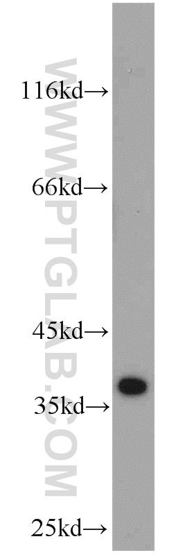 Western Blot (WB) analysis of Jurkat cells using MGME1 Polyclonal antibody (23178-1-AP)