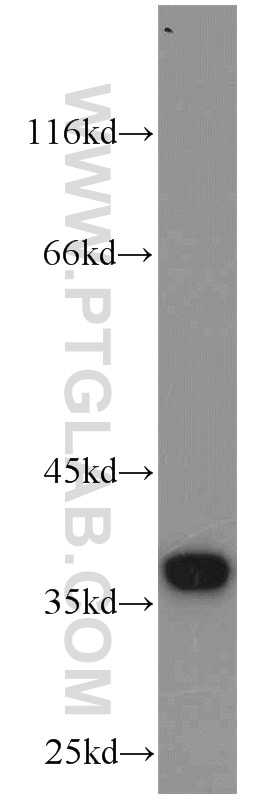 Western Blot (WB) analysis of Y79 cells using MGME1 Polyclonal antibody (23178-1-AP)