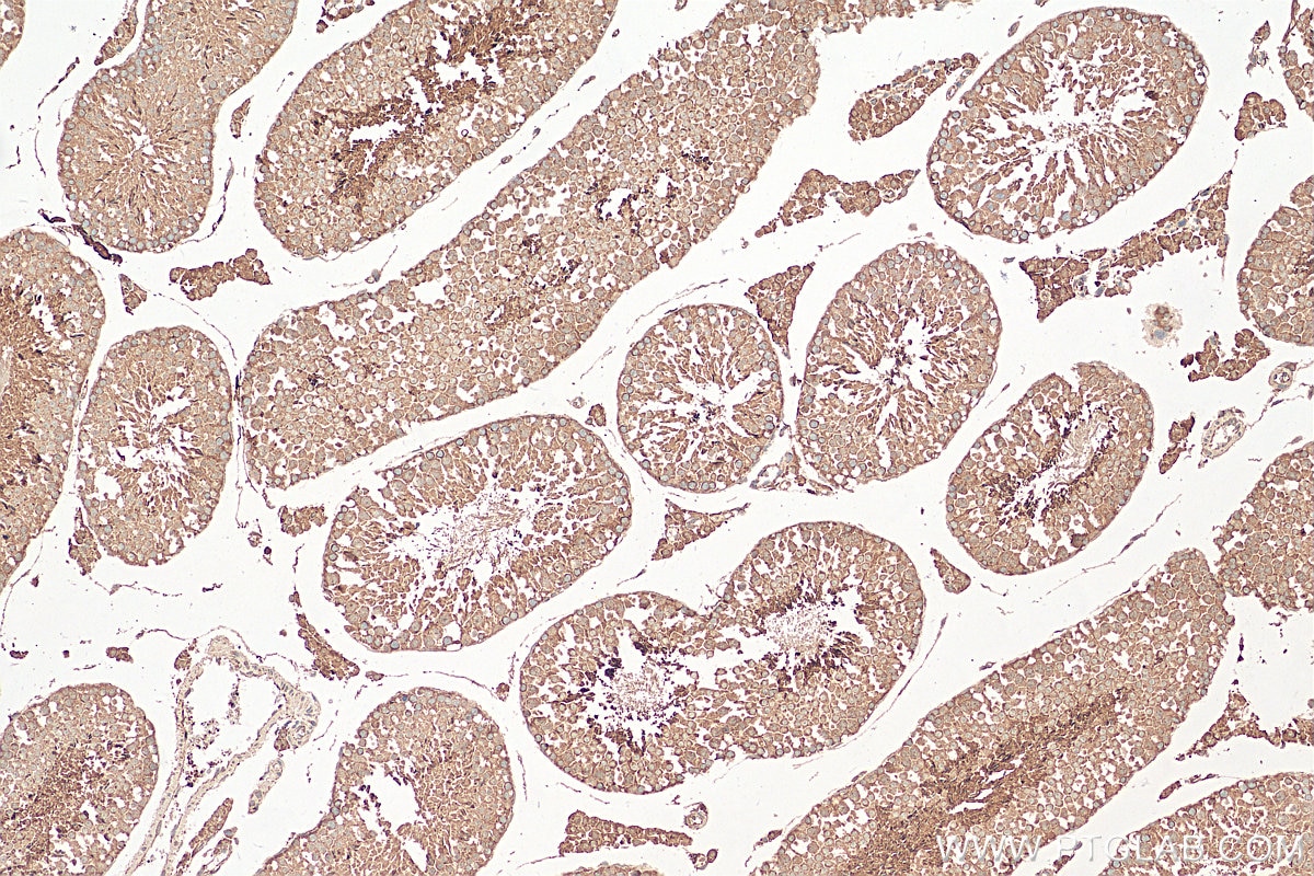 Immunohistochemistry (IHC) staining of mouse testis tissue using RALGAPA2 Polyclonal antibody (29843-1-AP)