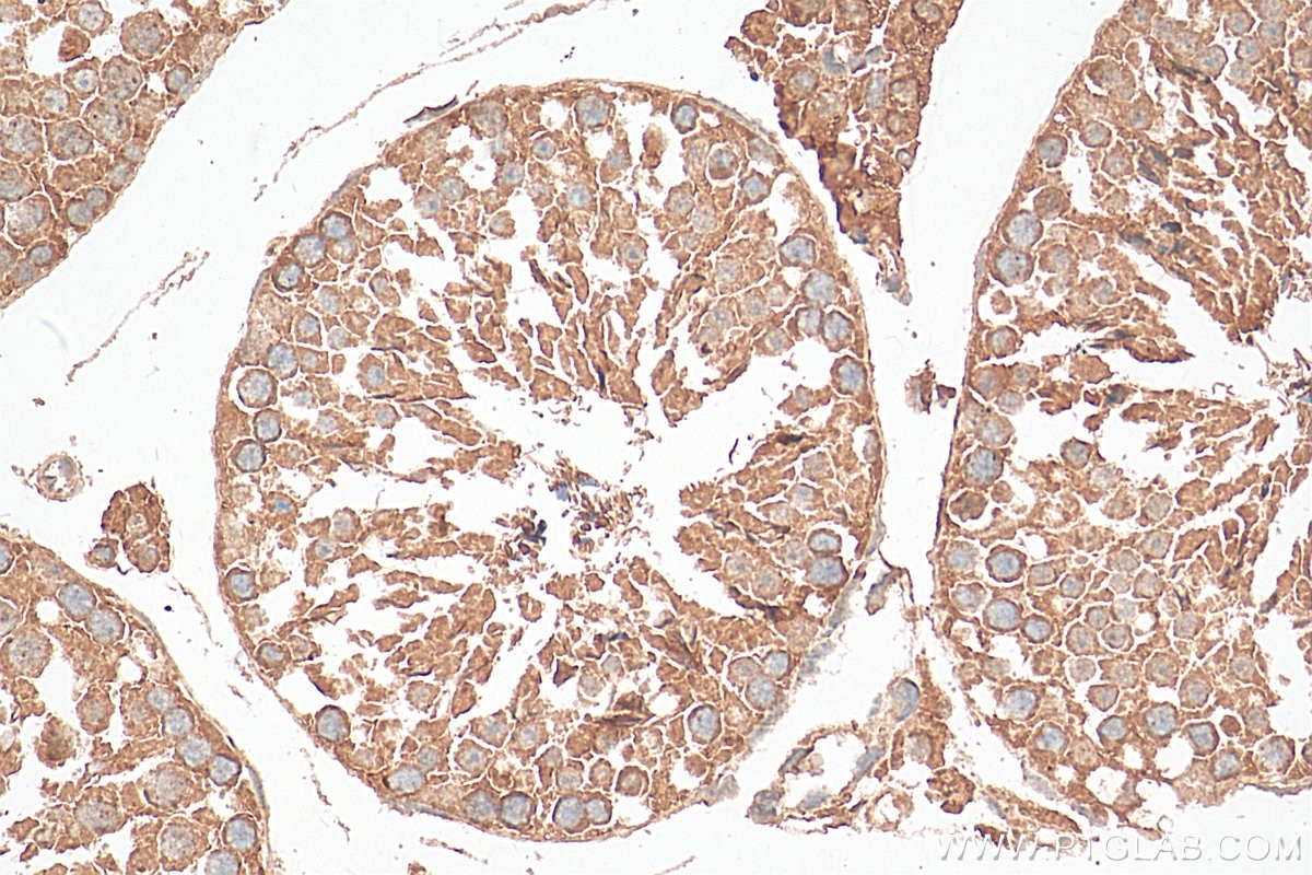 Immunohistochemistry (IHC) staining of mouse testis tissue using RALGAPA2 Polyclonal antibody (29843-1-AP)