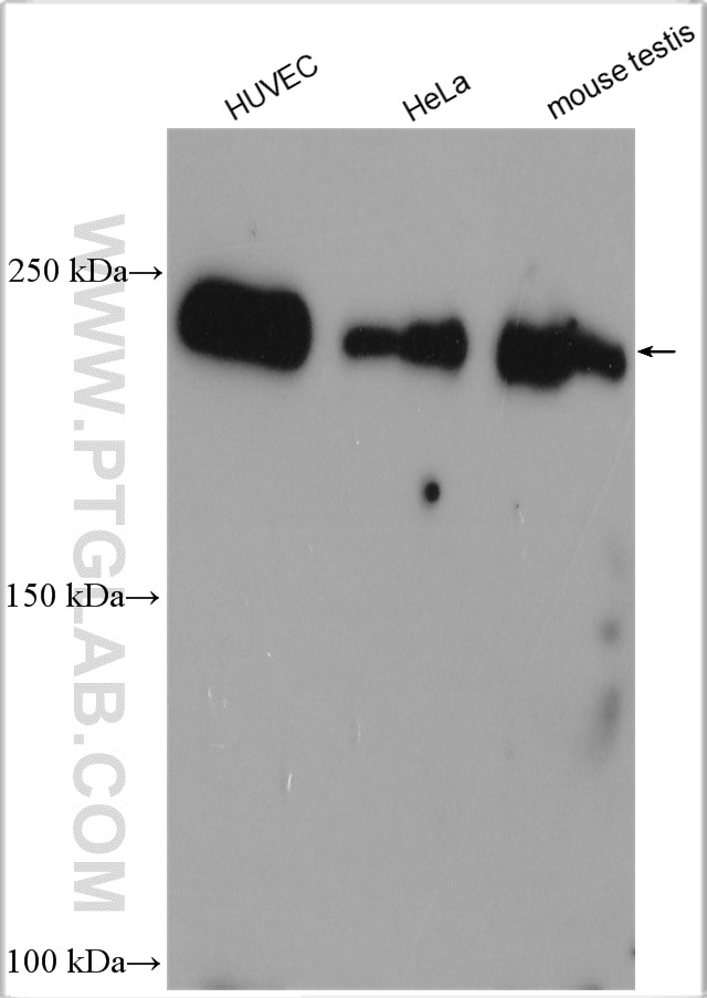 Western Blot (WB) analysis of various lysates using RALGAPA2 Polyclonal antibody (29843-1-AP)