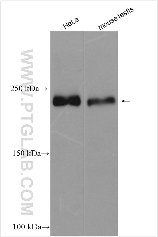 Western Blot (WB) analysis of various lysates using RALGAPA2 Polyclonal antibody (29843-1-AP)