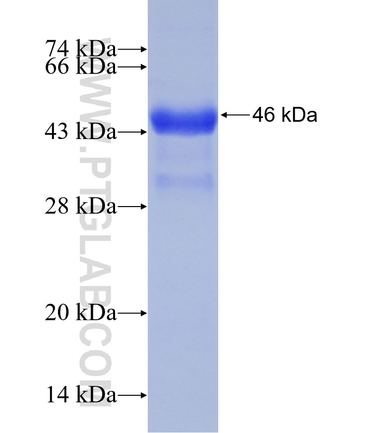 C20orf74 fusion protein Ag31460 SDS-PAGE