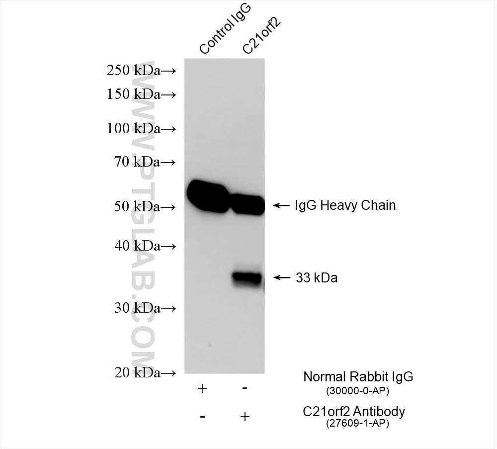 Immunoprecipitation (IP) experiment of HEK-293T cells using human C21orf2 Polyclonal antibody (27609-1-AP)