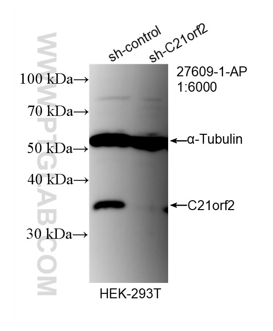 Western Blot (WB) analysis of HEK-293T cells using C21orf2 Polyclonal antibody (27609-1-AP)