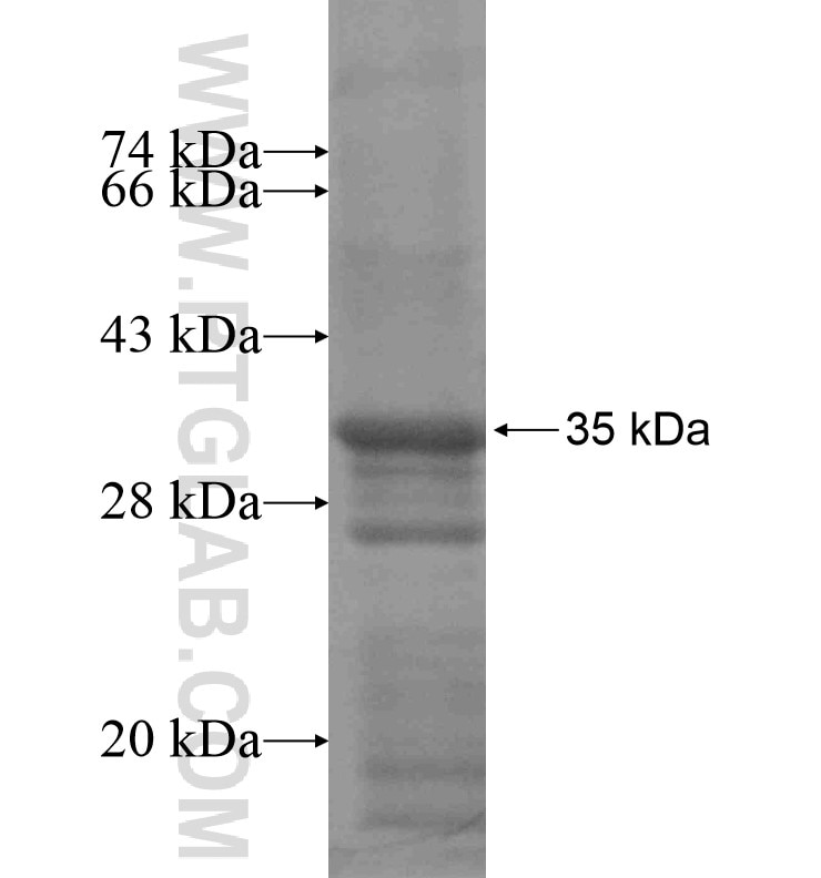 C21orf34 fusion protein Ag16643 SDS-PAGE