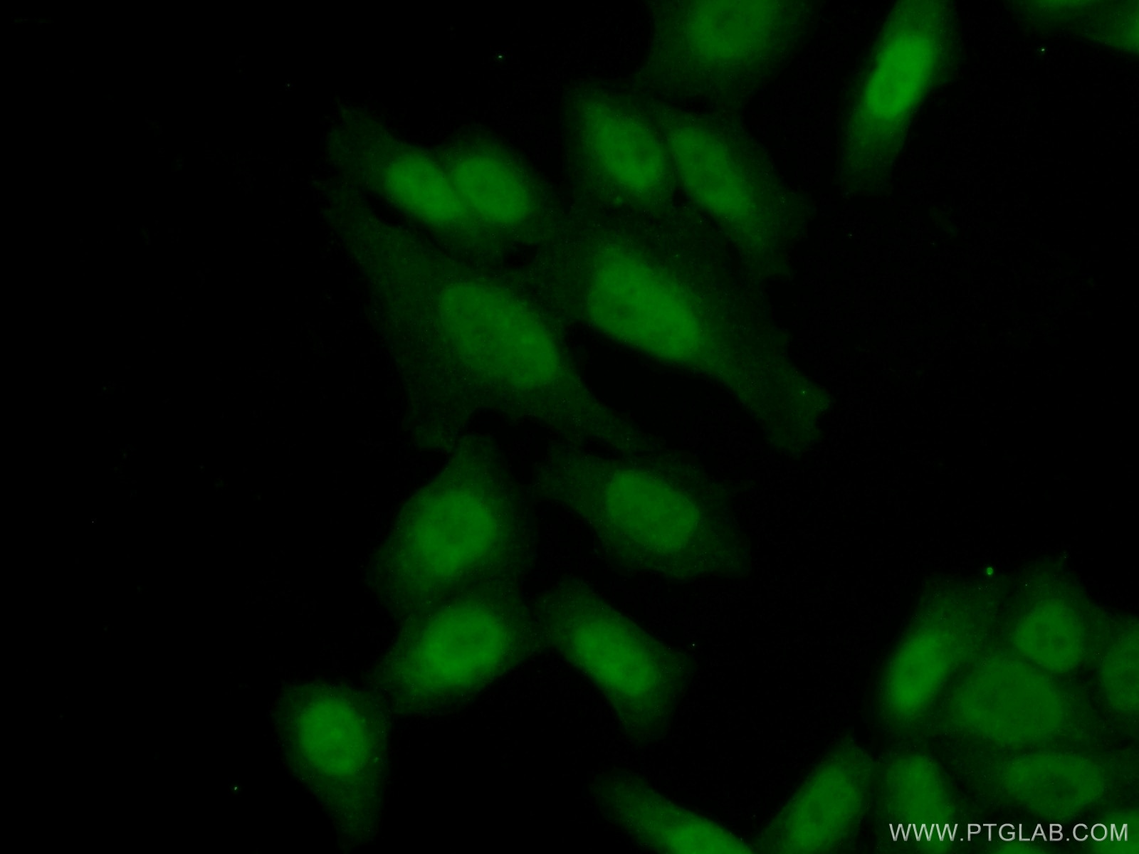Immunofluorescence (IF) / fluorescent staining of HeLa cells using C21orf45 Polyclonal antibody (25832-1-AP)