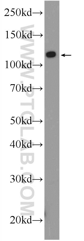 Western Blot (WB) analysis of HeLa cells using C21orf45 Polyclonal antibody (25832-1-AP)