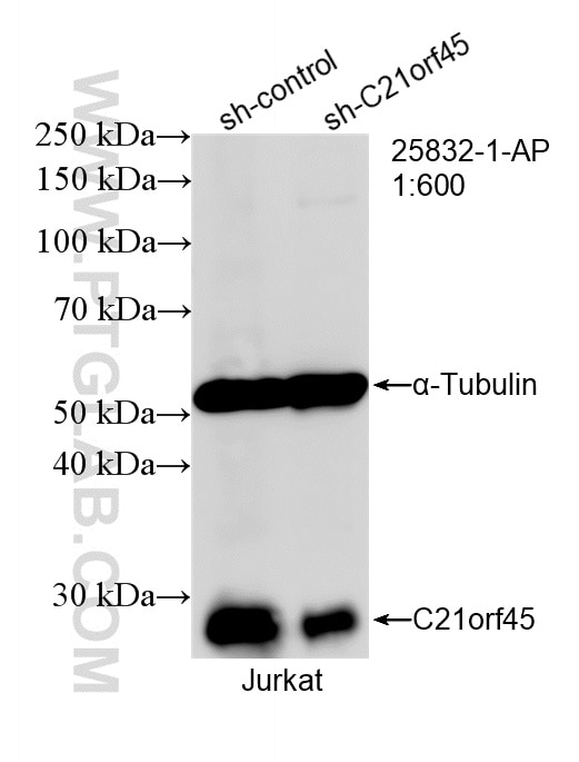Western Blot (WB) analysis of Jurkat cells using MIS18A Polyclonal antibody (25832-1-AP)