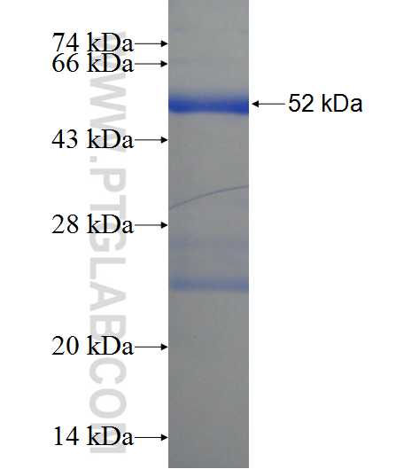C21orf45 fusion protein Ag22922 SDS-PAGE