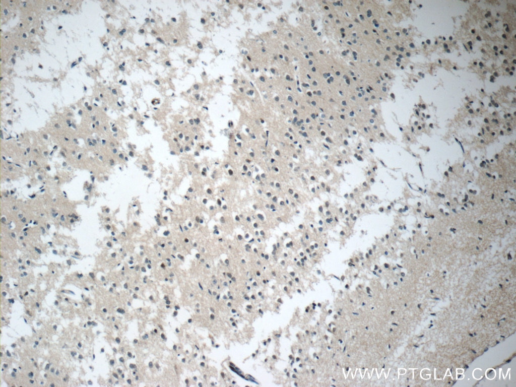 Immunohistochemistry (IHC) staining of human brain tissue using C21orf58 Polyclonal antibody (25024-1-AP)